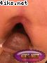 4iks_Net_Anal_000577.jpg